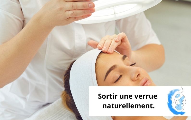 Sortir une verrue naturellement ?